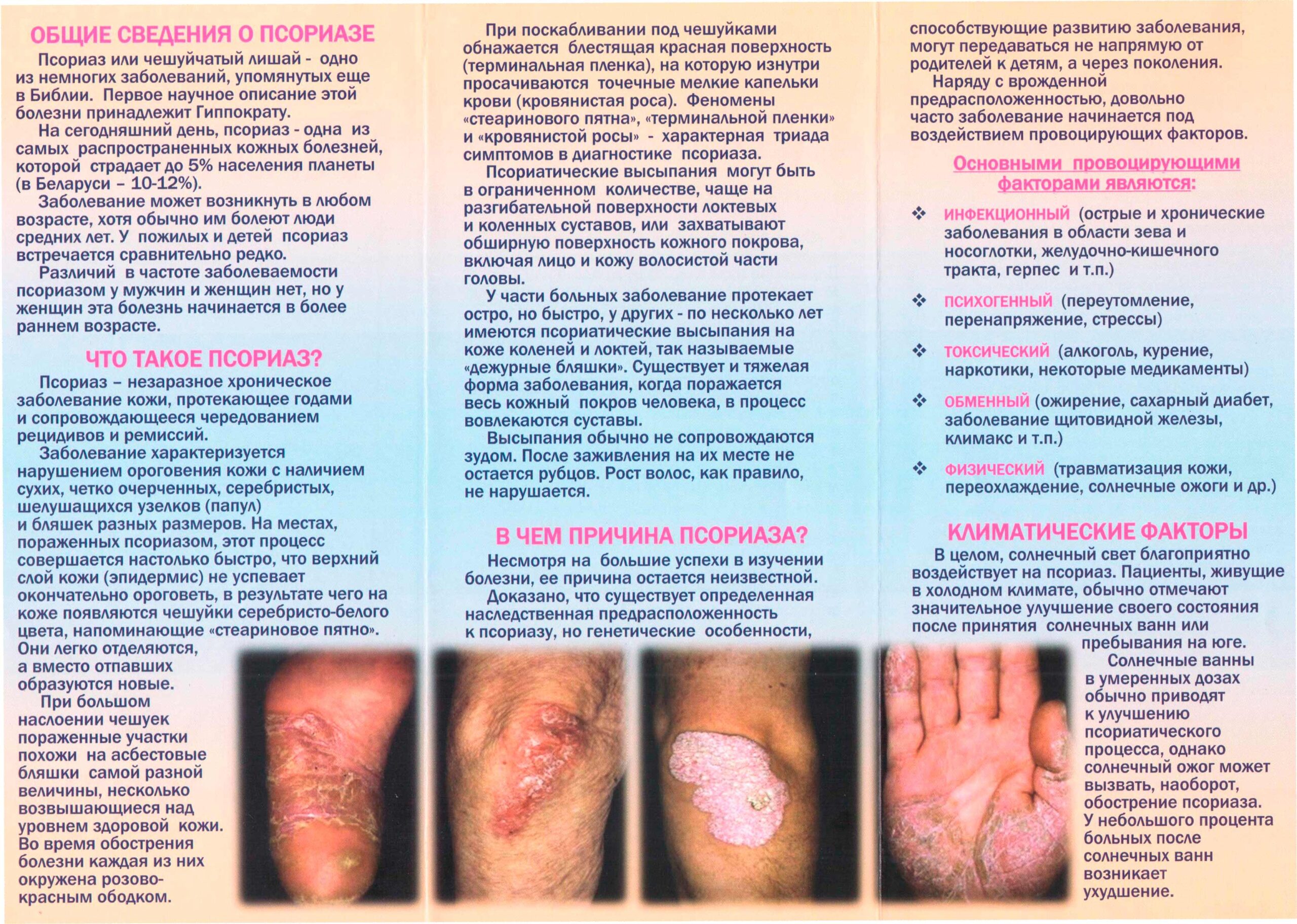 Псориаз как с ним жить 1