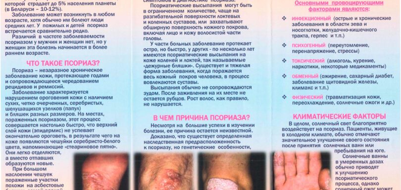 Псориаз как с ним жить 1