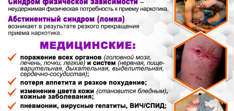 Флаер Последствия употребления наркотиков